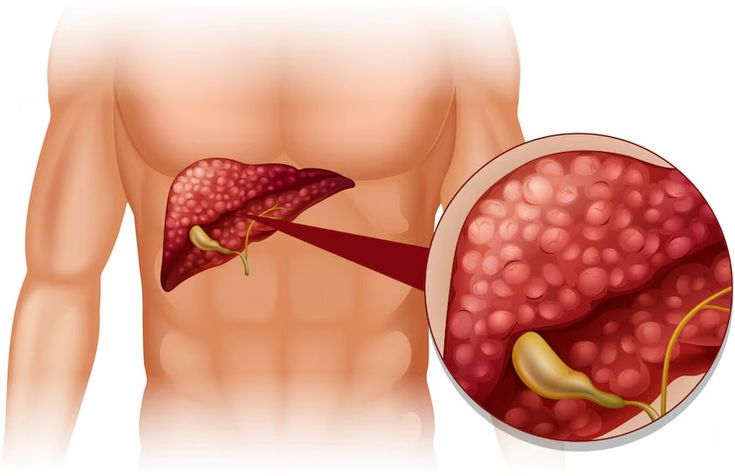 Gallbladder Cancer Treatment